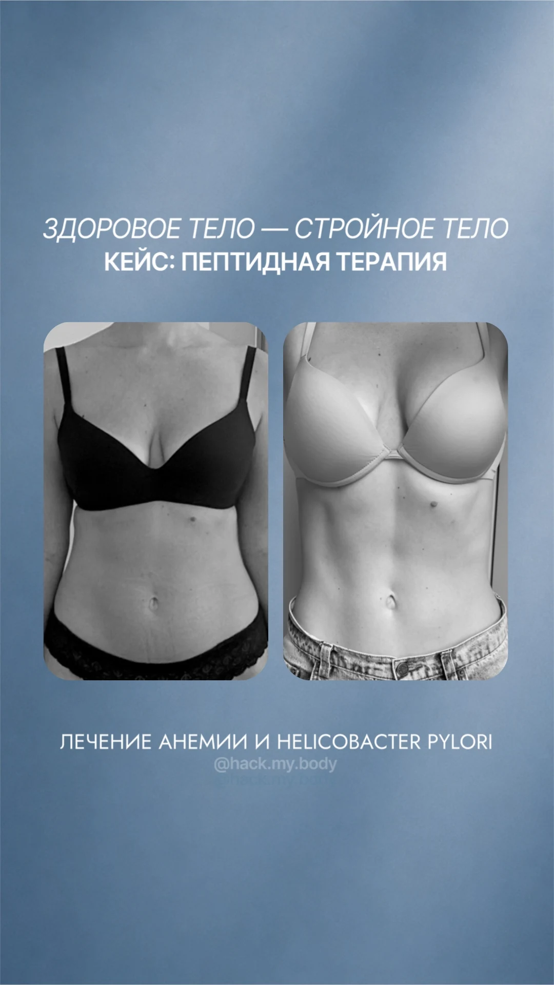 Кейс пептидной терапии: лечение анемии и Helicobacter pylori, анфас