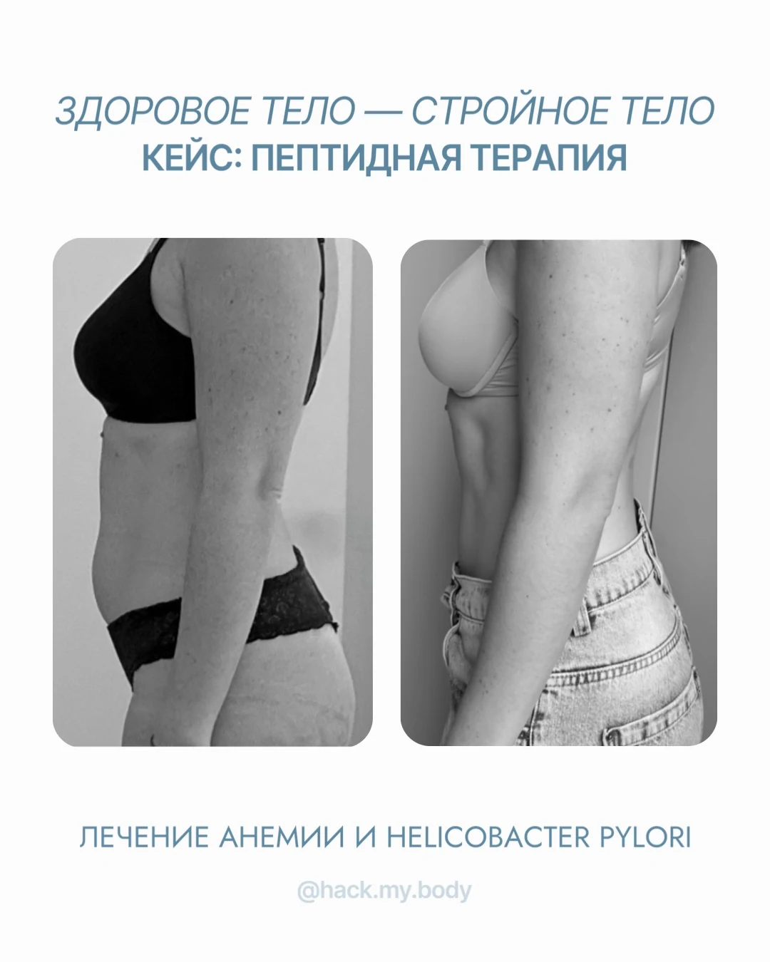 Кейс пептидной терапии: лечение анемии и Helicobacter pylori, профиль